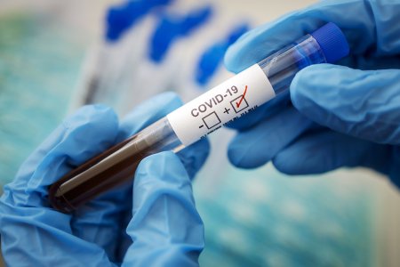 Две причины, по которым тест на коронавирус может показать неправильный результат