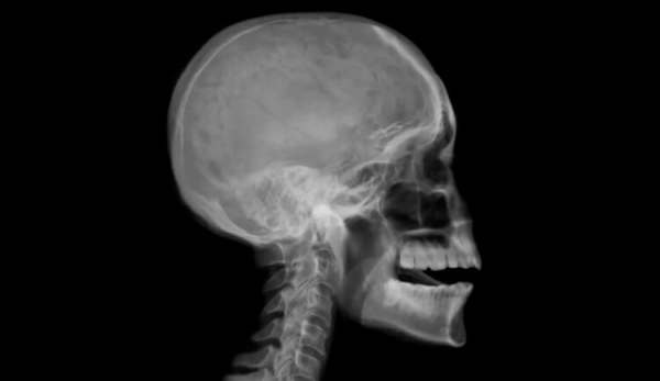 Хирурги пришили голову мальчику после того, как она была «почти полностью оторвана» - Hi-News.ru