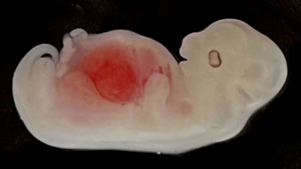 Эксперимент на грани биоэтики: ученые вырастили аналог человеческой почки внутри гибридного эмбриона - Hi-News.ru