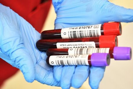 Почему первая группа крови оказалась самой опасной