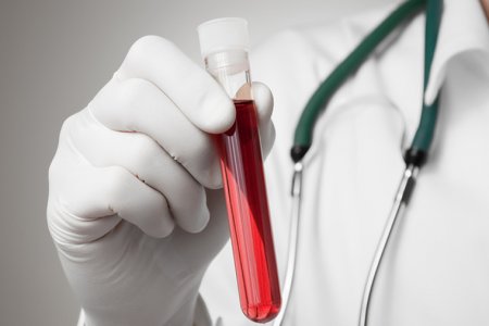 Как группа крови влияет на склонность человека к заболеваниям