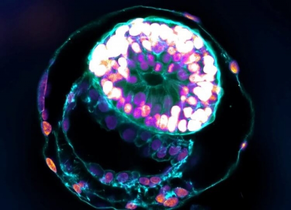 Ученые вырастили полную модель человеческого эмбриона, неотличимую от настоящего - Hi-News.ru