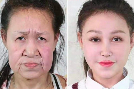 В Китае врачи подарили больной девочке новое лицо