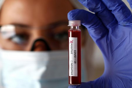 Новые симптомы коронавируса назвали немецкие врачи